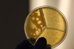 A hand holds up a yellow Petri dish divided into thirds with some spots.