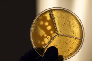 A hand holds up a yellow Petri dish divided into thirds with some spots.